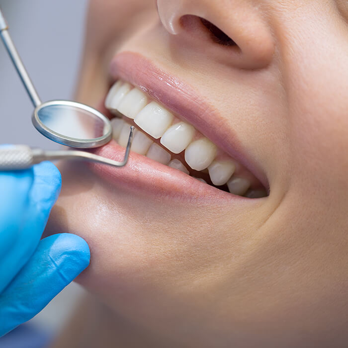 Dental examination is done before procedure. Careful teeth examination before placing the bridge.
