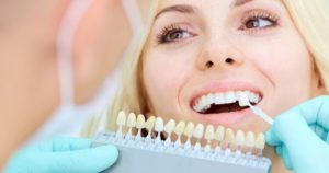 Dentist holding tooth shade to woman's smile for teeth whitening