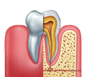 An image shows a tooth and the inner structure of the pulp and the nerve.